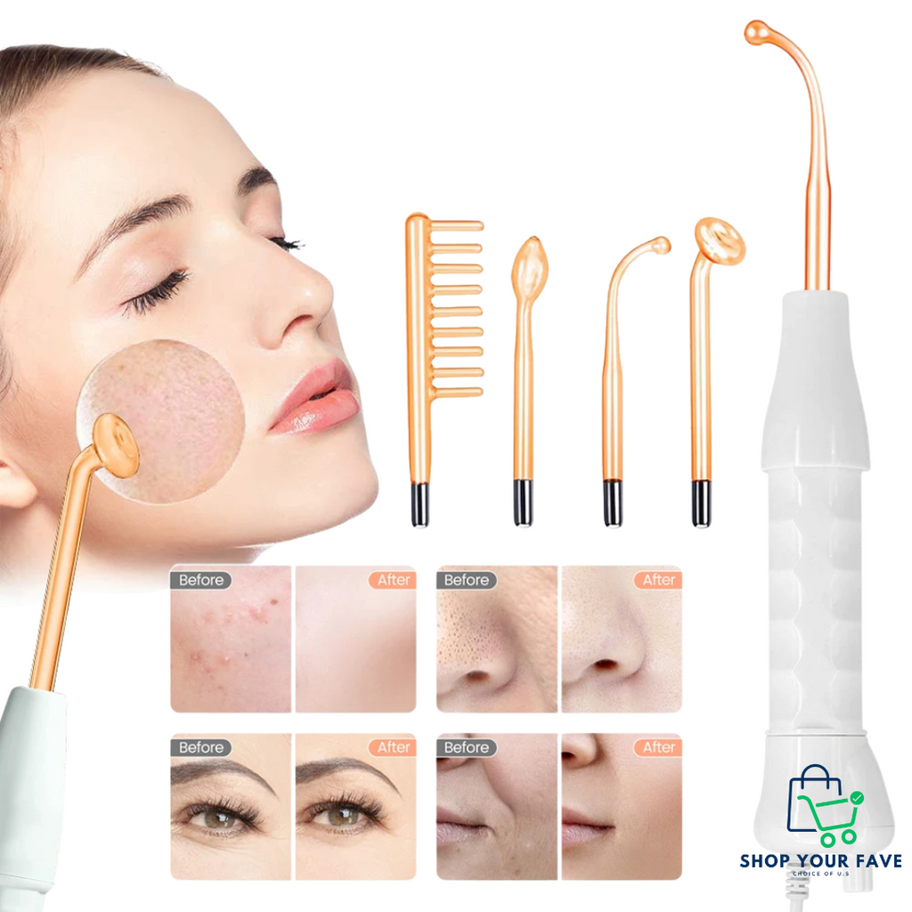 High Frequency Facial Wand