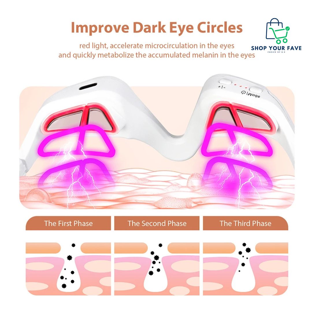 Eye Electric Massager – Dark Circle & Eye Bag Removal Device