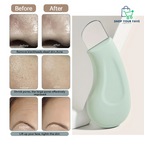 Blackhead and Whitehead Remover