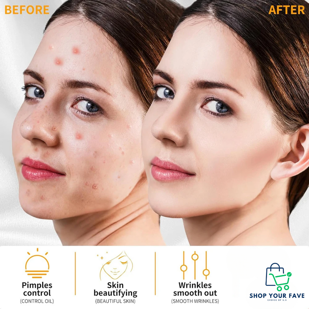 High Frequency Facial Wand