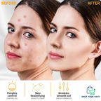 High Frequency Facial Wand