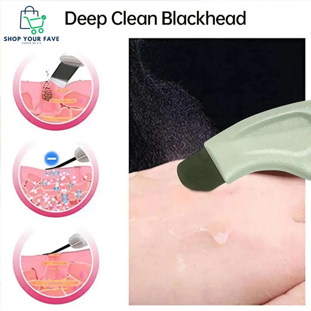 Blackhead and Whitehead Remover
